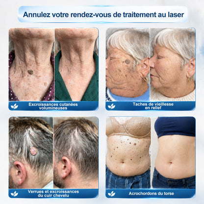 🎉 Félicitations, vous êtes le/la 99ᵉ client(e) de notre boutique 🎁 Il ne reste plus que 10 paquets disponibles ! 𝑷𝑖𝒄𝐝𝐨® – Profitez aujourd’hui d’une remise exclusive de 30 % !
