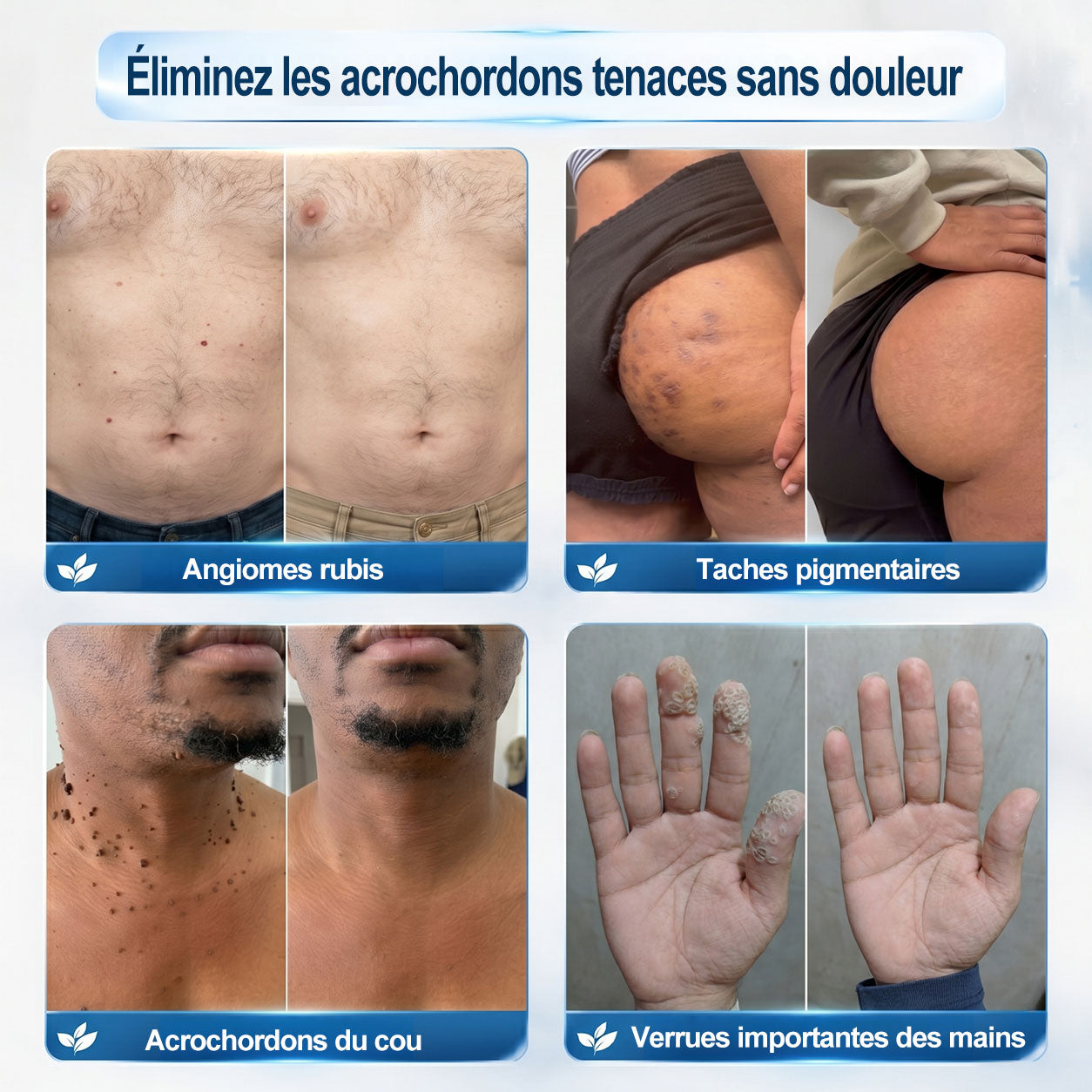 🎉 Félicitations, vous êtes le/la 99ᵉ client(e) de notre boutique 🎁 Il ne reste plus que 10 paquets disponibles ! 𝑷𝑖𝒄𝐝𝐨® – Profitez aujourd’hui d’une remise exclusive de 30 % !