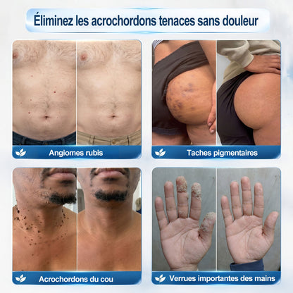 🎉 Félicitations, vous êtes le/la 99ᵉ client(e) de notre boutique 🎁 Il ne reste plus que 10 paquets disponibles ! 𝑷𝑖𝒄𝐝𝐨® – Profitez aujourd’hui d’une remise exclusive de 30 % !