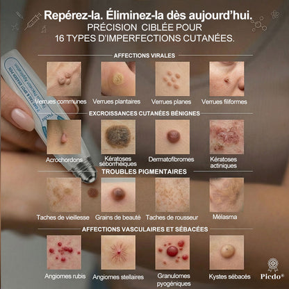 🎉 Félicitations, vous êtes le/la 99ᵉ client(e) de notre boutique 🎁 Il ne reste plus que 10 paquets disponibles ! 𝑷𝑖𝒄𝐝𝐨® – Profitez aujourd’hui d’une remise exclusive de 30 % !