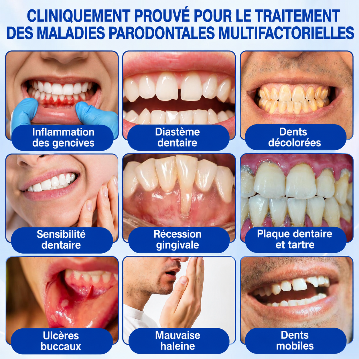 🇫🇷 𝑮𝒍𝒊𝒎𝒎𝒆𝒓𝒍𝒚®🦷 𝑮𝒖𝒎𝑹𝒆𝒗𝒊𝒗𝒆 𝑮𝒆𝒍 𝒅𝒆 𝑹é𝒑𝒂𝒓𝒂𝒕𝒊𝒐𝒏 𝑷𝒂𝒓𝒐𝒅𝒐𝒏𝒕𝒂𝒍𝒆🌈