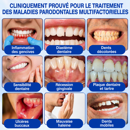 🇫🇷 𝑮𝒍𝒊𝒎𝒎𝒆𝒓𝒍𝒚®🦷 𝑮𝒖𝒎𝑹𝒆𝒗𝒊𝒗𝒆 𝑮𝒆𝒍 𝒅𝒆 𝑹é𝒑𝒂𝒓𝒂𝒕𝒊𝒐𝒏 𝑷𝒂𝒓𝒐𝒅𝒐𝒏𝒕𝒂𝒍𝒆🌈