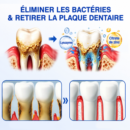 🇫🇷 𝑮𝒍𝒊𝒎𝒎𝒆𝒓𝒍𝒚®🦷 𝑮𝒖𝒎𝑹𝒆𝒗𝒊𝒗𝒆 𝑮𝒆𝒍 𝒅𝒆 𝑹é𝒑𝒂𝒓𝒂𝒕𝒊𝒐𝒏 𝑷𝒂𝒓𝒐𝒅𝒐𝒏𝒕𝒂𝒍𝒆🌈