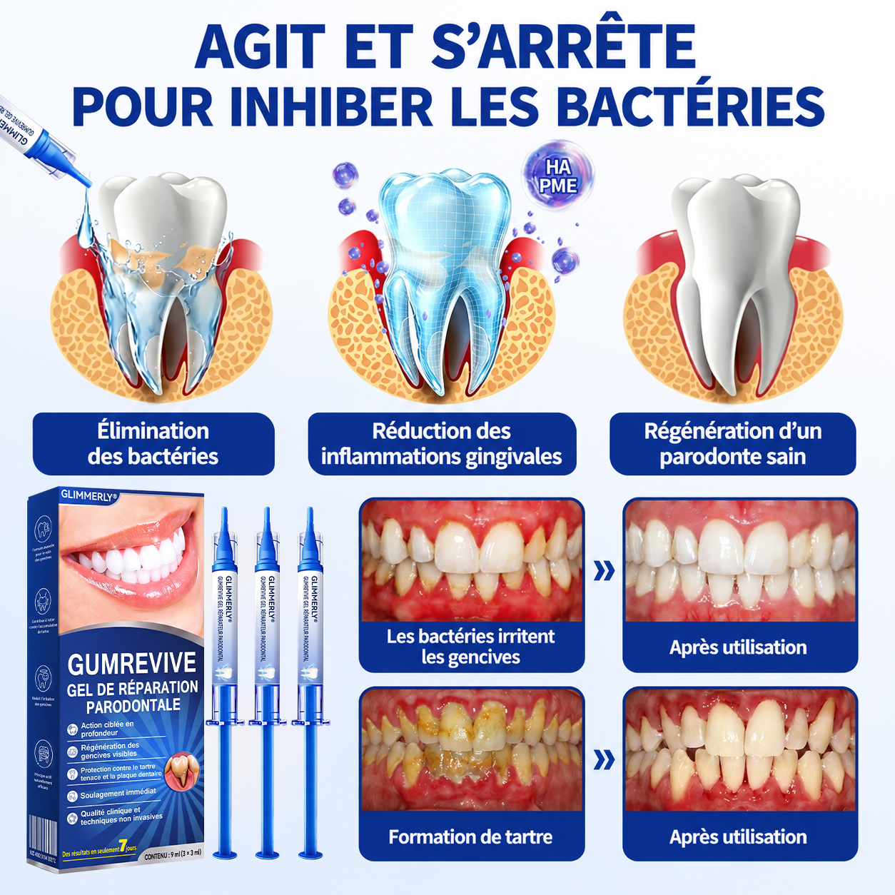 🇫🇷 𝑮𝒍𝒊𝒎𝒎𝒆𝒓𝒍𝒚®🦷 𝑮𝒖𝒎𝑹𝒆𝒗𝒊𝒗𝒆 𝑮𝒆𝒍 𝒅𝒆 𝑹é𝒑𝒂𝒓𝒂𝒕𝒊𝒐𝒏 𝑷𝒂𝒓𝒐𝒅𝒐𝒏𝒕𝒂𝒍𝒆🌈